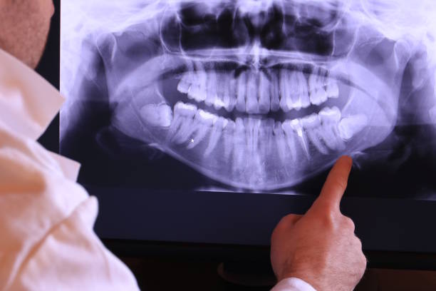 Best Emergency Treatment for Dental Infections or Abscesses in Prescott, WI