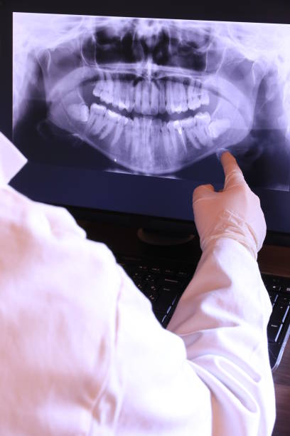 Best Urgent Care for Lost Fillings or Crowns in Prescott, WI